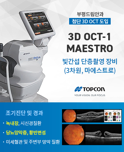 3d-oct